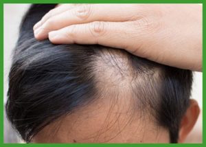 fragilidad-capilar-analisis-en-farmacia-santias-aspe